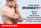Confirmados primeiros casos de Monkeypox no interior Baiano