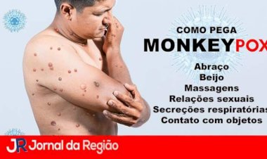 Confirmados primeiros casos de Monkeypox no interior Baiano